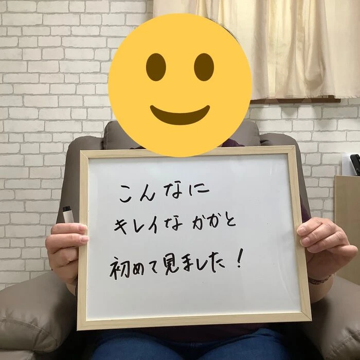 画像1976：30代女性/肥厚爪ケア