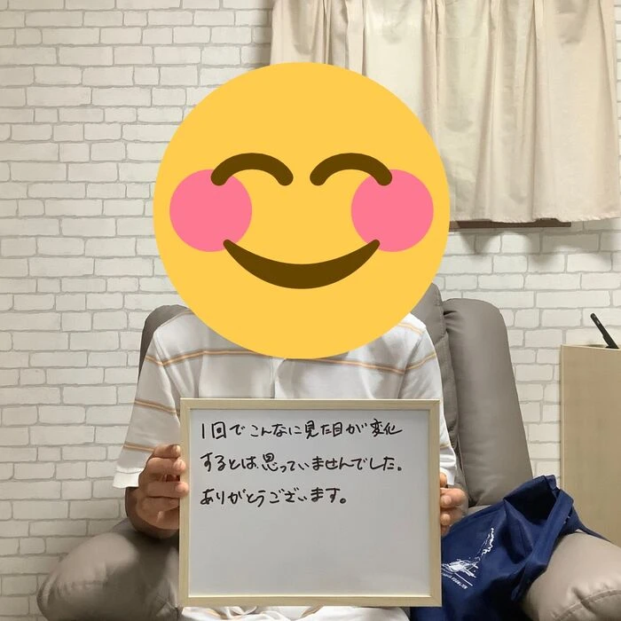 画像3395：30代女性/肥厚爪ケア