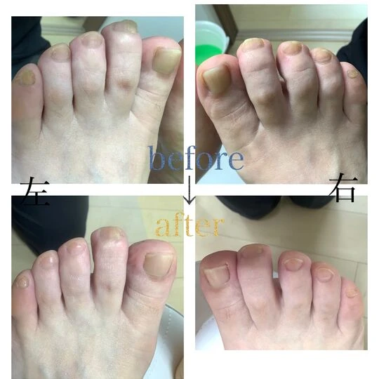 画像3930：60代女性/トータルフットケア
