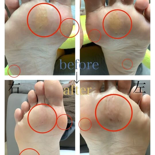 画像4549：30代女性/トータルフットケア