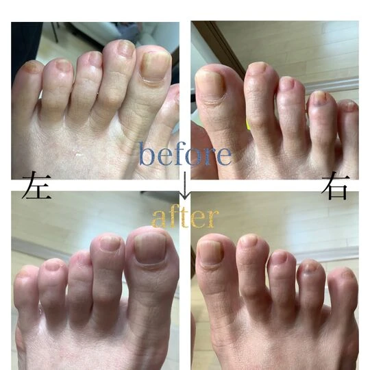 画像4569：50代女性/トータルフットケア